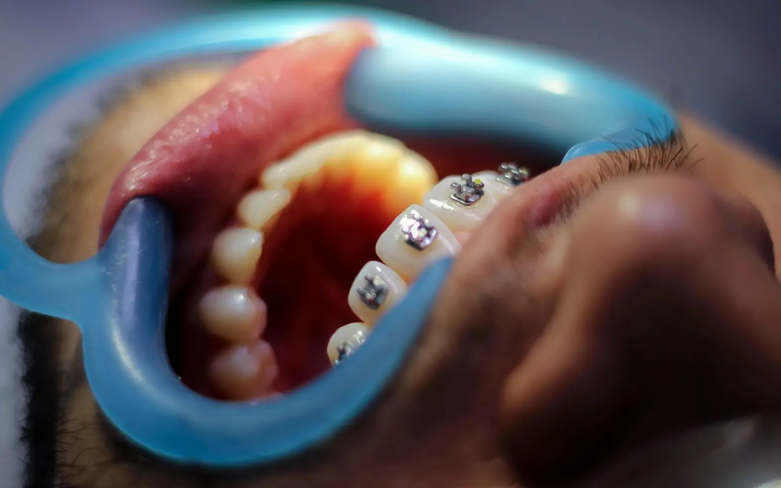 Orthodontics, dentistry and patient